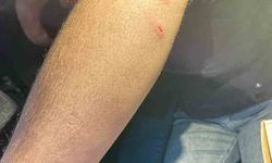 Siirt’te oto sanayisinde sokak köpeklerinin saldırdığı genç yaralandı