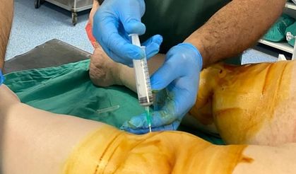 Özel Siirt Hayat Hastanesinde Diz Kireçlenmesine Ameliyatsız Yöntem